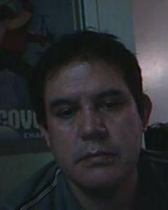 Man, 63. huesos476