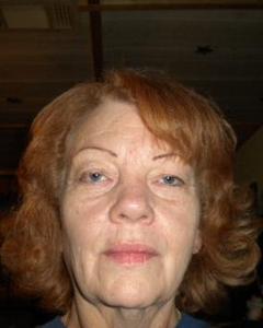 Woman, 77. grasshoppe4331