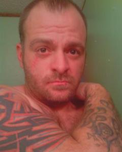 Man, 48. rrplezubb