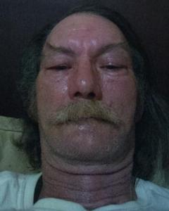 Man, 66. owaynemo