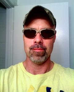 Man, 53. myvet