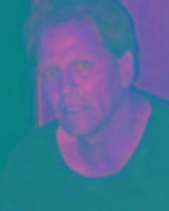 Man, 60. beekuz