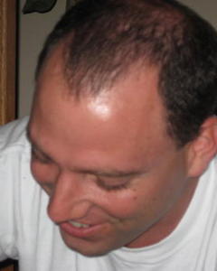Man, 45. ms001079