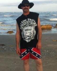 Man, 55. Thigh