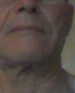 Man, 70. elephantdog