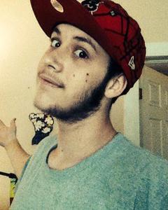 Man, 29. Right_Eye420