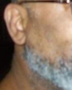 Man, 74. spike514288