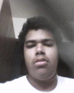 Man, 28. scarteven
