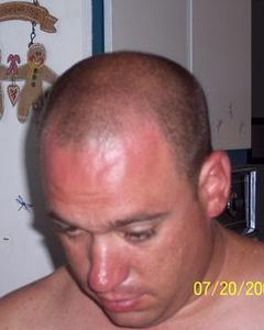 Man, 51. aceholeisi