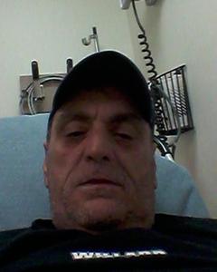 Man, 62. runcke