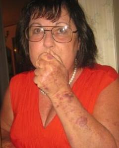 Woman, 66. Shirel