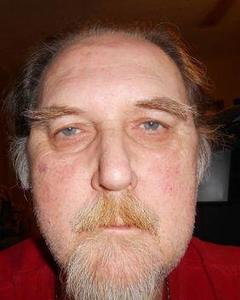 Man, 74. tally_wack5105