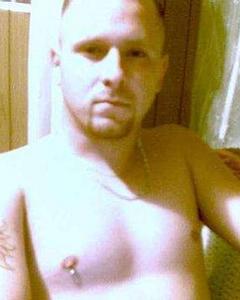 Man, 44. scar_187_tw