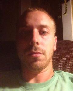 Man, 35. Case2563