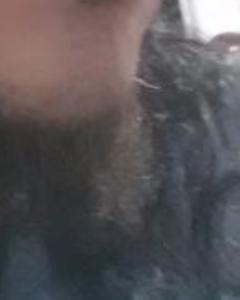 Man, 36. mosterinthebed