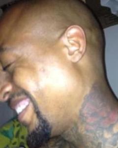Man, 43. Ruefareal