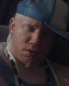 Man, 44. ALBINO_REDD81