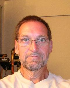 Man, 67. INxplant