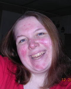 Woman, 45. harms223