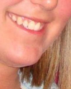 Woman, 35. Melba