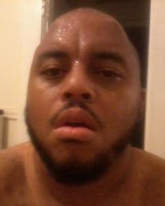 Man, 53. head4181