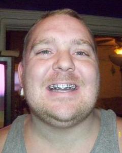 Man, 45. neverforgetmik