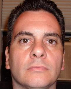 Man, 59. beforemyeyes