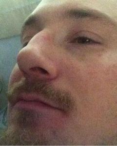 Man, 42. Cheynepain