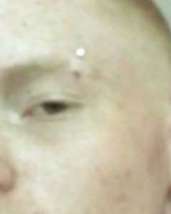Man, 35. karm1