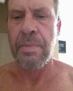 Man, 63. neespuss