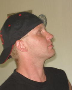 Man, 48. hifukr