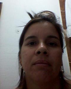Woman, 45. dayioma