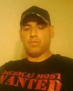Man, 49. sicca