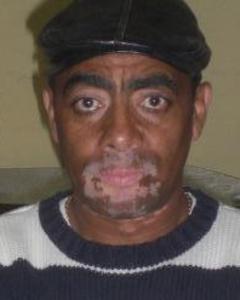 Man, 63. vitiligo13