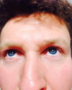 Man, 45. Fstorck