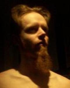 Man, 47. Nodus375