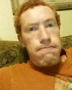 Man, 34. welch3