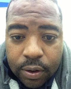Man, 60. Kenntoohappy