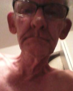 Man, 65. cutis6