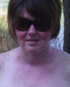 Woman, 49. katkit