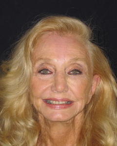 Woman, 84. LEELEE499