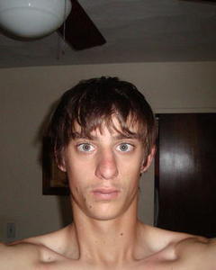 Man, 35. trukes