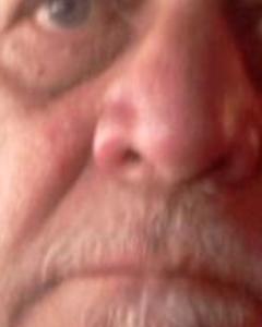 Man, 77. mtway