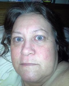 Woman, 60. guinea_pig