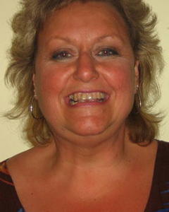 Woman, 65. tootru610