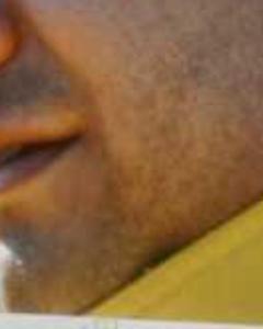 Man, 43. yismo