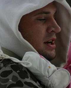 Man, 35. rynclegg
