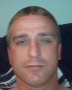 Man, 48. scalburt