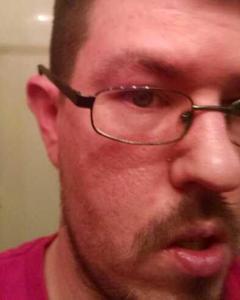 Man, 42. ohio11