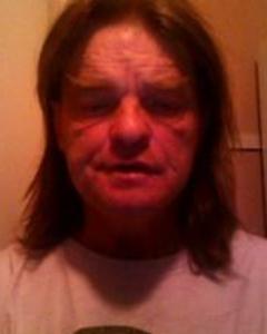Man, 62. troyny12180